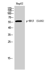 ERβ (phospho Ser105) Polyclonal Antibody