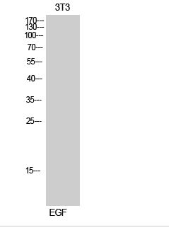 MerTK/Tyro3 (phospho Tyr749/681) Polyclonal Antibody