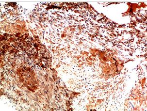 Collagen II Mouse Monoclonal Antibody(1H1)