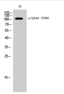 EphA4 (phospho Tyr596) Polyclonal Antibody