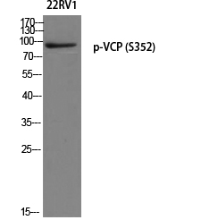 VCP (phospho Ser352) Polyclonal Antibody