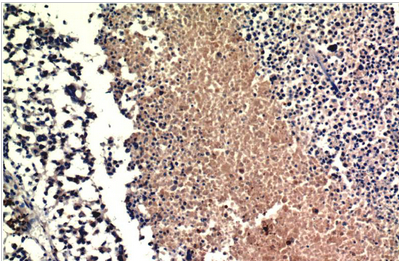 PTEN Mouse Monoclonal Antibody(9E8)