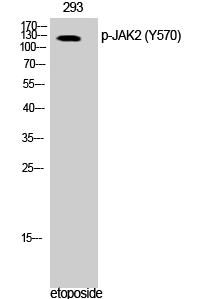 JAK2 (phospho Tyr570) Polyclonal Antibody