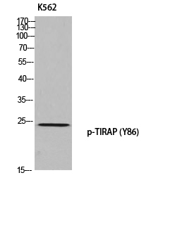 TIRAP (phospho Tyr86) Polyclonal Antibody
