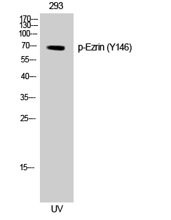 Ezrin (phospho Tyr146) Polyclonal Antibody