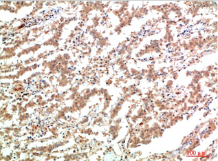 JAK2 Mouse Monoclonal Antibody(3F10)