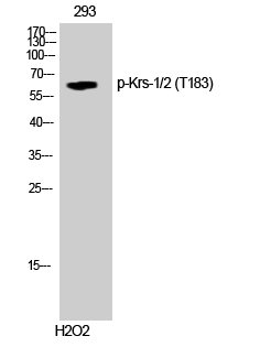 p130 Cas (phospho Tyr165) Polyclonal Antibody