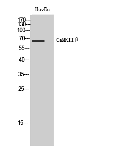 CaMKK2 Polyclonal Antibody