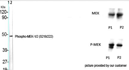 MEK-1/2 (phospho Ser218/222) Polyclonal Antibody