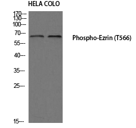 Ezrin (phospho Thr566) Polyclonal Antibody