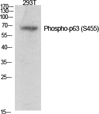 p63 (phospho Ser455) Polyclonal Antibody