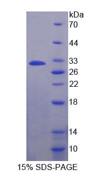 Recombinant A Disintegrin And Metalloprotease 22 (ADAM22)