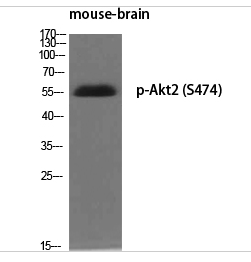 Akt2 (phospho Ser474) Polyclonal Antibody
