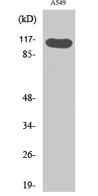 Hrs (phospho Tyr216) Polyclonal Antibody
