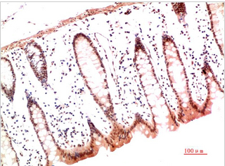 Collagen I Mouse Monoclonal Antibody(2D10)