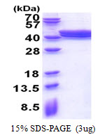 ACAD8, 23-415aa, Human, His tag, E Coli