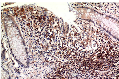 Epsilon Tubulin Mouse Monoclonal Antibody(3C1)