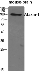 Ataxin-1 Polyclonal Antibody
