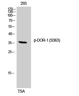 DOR-1 (phospho Ser363) Polyclonal Antibody