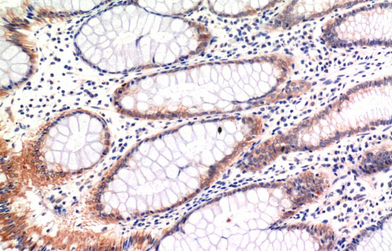 phospho-MLKL (S358) Mouse Monoclonal Antibody(6B4)