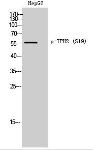 TPH2 (phospho Ser19) Polyclonal Antibody