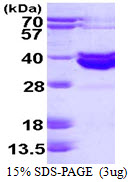 ABO, 54-354aa, Human, His tag, E Coli