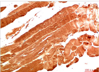 NBR1 Mouse Monoclonal Antibody(7C3)