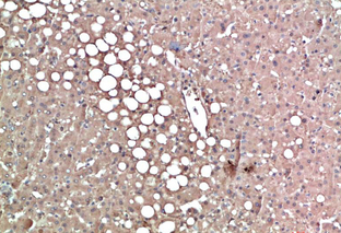 TTR Mouse Monoclonal Antibody(3G7)