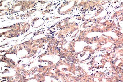GSK3β Mouse Monoclonal Antibody(1A6)