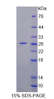 Recombinant A Disintegrin And Metalloproteinase With Thrombospondin 9 (ADAMTS9)