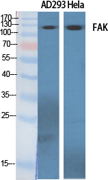 FAK Polyclonal Antibody