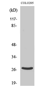 DHRS2 Polyclonal Antibody