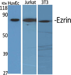Ezrin Polyclonal Antibody