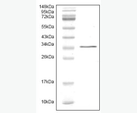 Recombinant Mouse Interleukin-1β/IL-1β