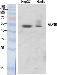 GLP-1R Polyclonal Antibody