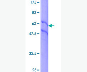 Recombinant Human Coagulation Factor XIII A Chain