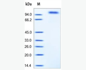 Recombinant Human TNF Receptor Superfamily Member 11B/OPG