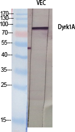 Dyrk1A Polyclonal Antibody