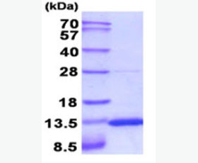 Recombinant Human Ephrin-A1/EFNA1/LERK-1