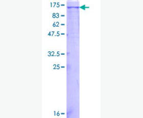 Recombinant Human Lymphocyte Function-associated Antigen 3/CD58/LFA-3