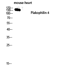 Plakophilin 4 Polyclonal Antibody