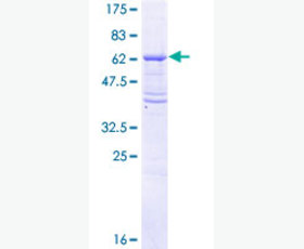 Recombinant Human Interleukin-8/IL-8