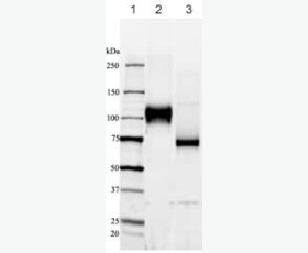 Recombinant Human Hepatocyte Growth Factor Receptor/HGF R/cMet