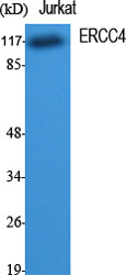 ERCC4 Polyclonal Antibody