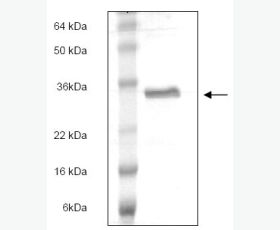 Recombinant Human Fructose-1,6-Bisphosphatase 1/FBPase 1