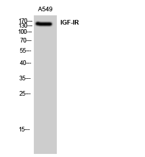 IGF-IR Polyclonal Antibody