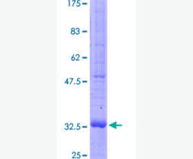 Recombinant Human C-C Motif Chemokine 3/CCL3