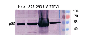 p53 Polyclonal Antibody