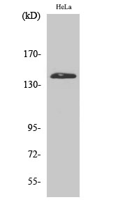 PERK Polyclonal Antibody