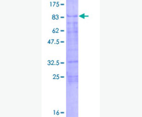 Recombinant Human NKG2A & CD94 Heterodimer